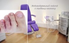 Франшиза Центр ПОДО-Педикюра: Безоперационная методика устранения подологических проблем