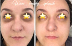 Франшиза WOW BEAUTY: Инвазивная косметология