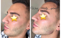 Франшиза WOW BEAUTY: Инвазивная косметология