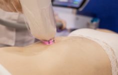Франшиза Dr.Laser: Студия лазерной эпиляции